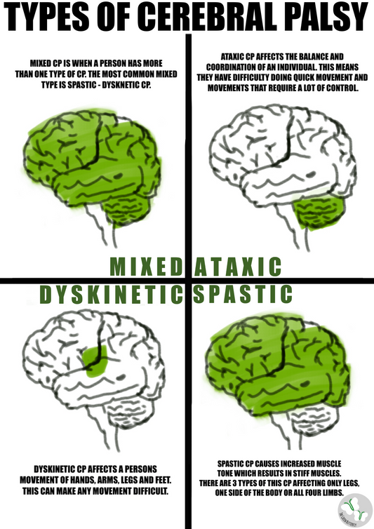 4 Types of CP Poster